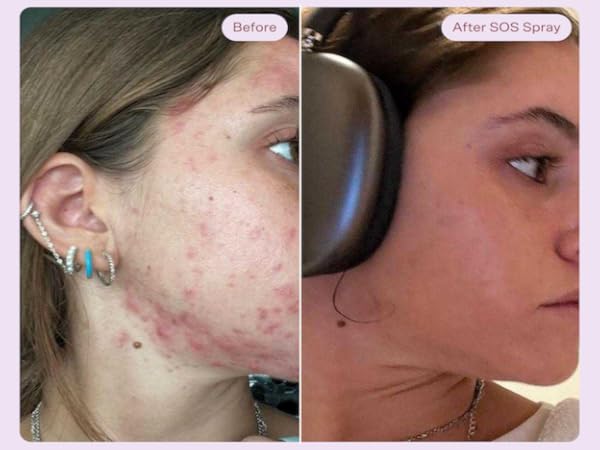 tower 28 sos body wash: gel limpiador suave diseñado para aliviar y calmar la piel irritada, proporcionando limpieza efectiva y confort instantáneo.