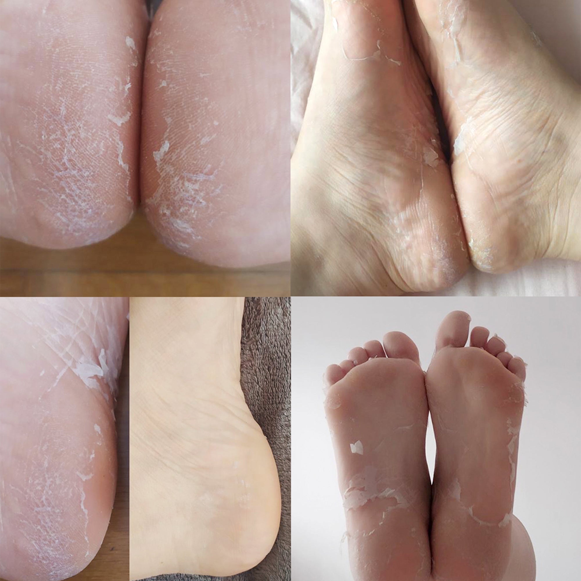 descubre nuestras mascarillas calcetín para exfoliación que suavizan y renuevan tu piel, ofreciendo una limpieza profunda y un acabado radiante.