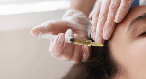 descubre los tratamientos de ácido hialurónico para el cuero cabelludo que hidratan y revitalizan tu piel, promoviendo un crecimiento capilar saludable y un cabello más fuerte.